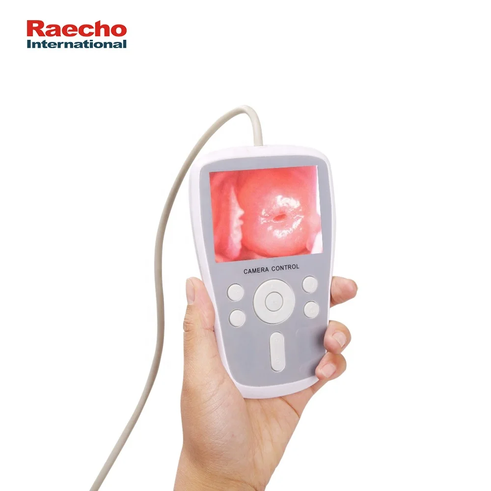 Good Quality Handheld Video Colposcope Digital Gynecology Hospital Convenient