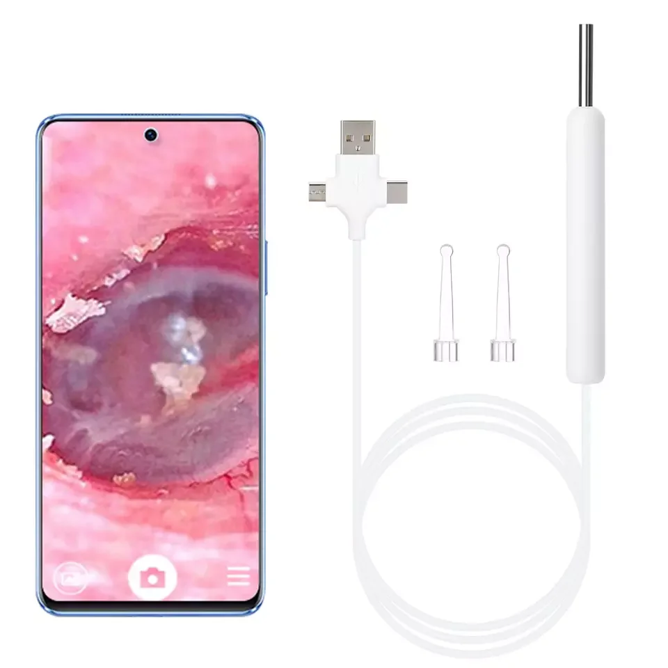 Factory Hot Seller 3 In 1 Usb Visual Otoscope Camera Hd Ear Wax Removal Cleaning Tool Ear Endoscope