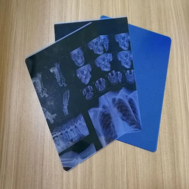 Medical print X-ray film