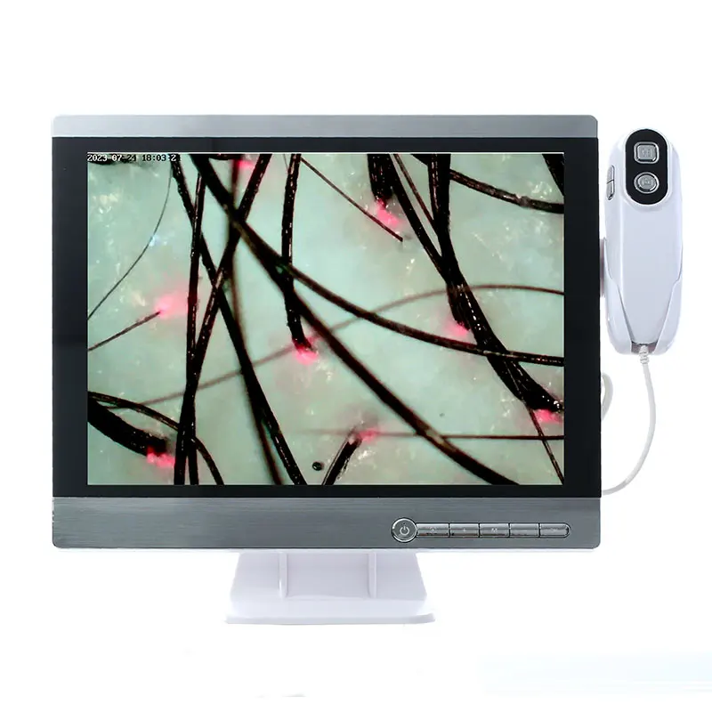Wireless scalp scanner camera HD hair follicle hair skin analyzer to take photos and video analysis