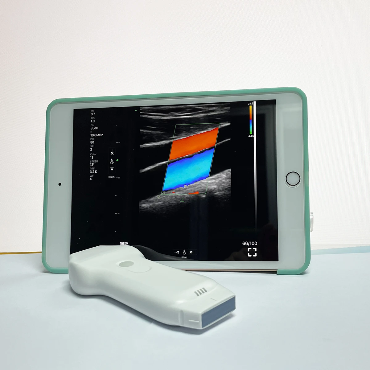 CE Double Probes Wireless Color Doppler Ultrasound Scanner