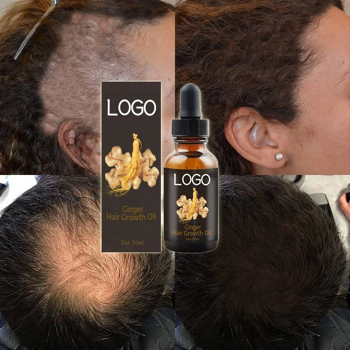 OEM Custom Private Label Hair Treatment Smooth Repair Hair Loss Thicker Ginger Hair Growth Oil Serum