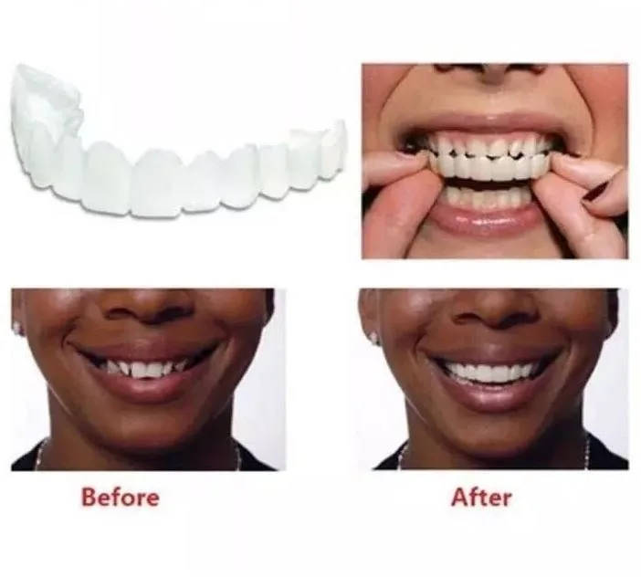 Upper And Lower Teeth Accessories Cover Silicone Artificial Teeth Cosmetic Dentistry Fits Most Comfortable Denture Car