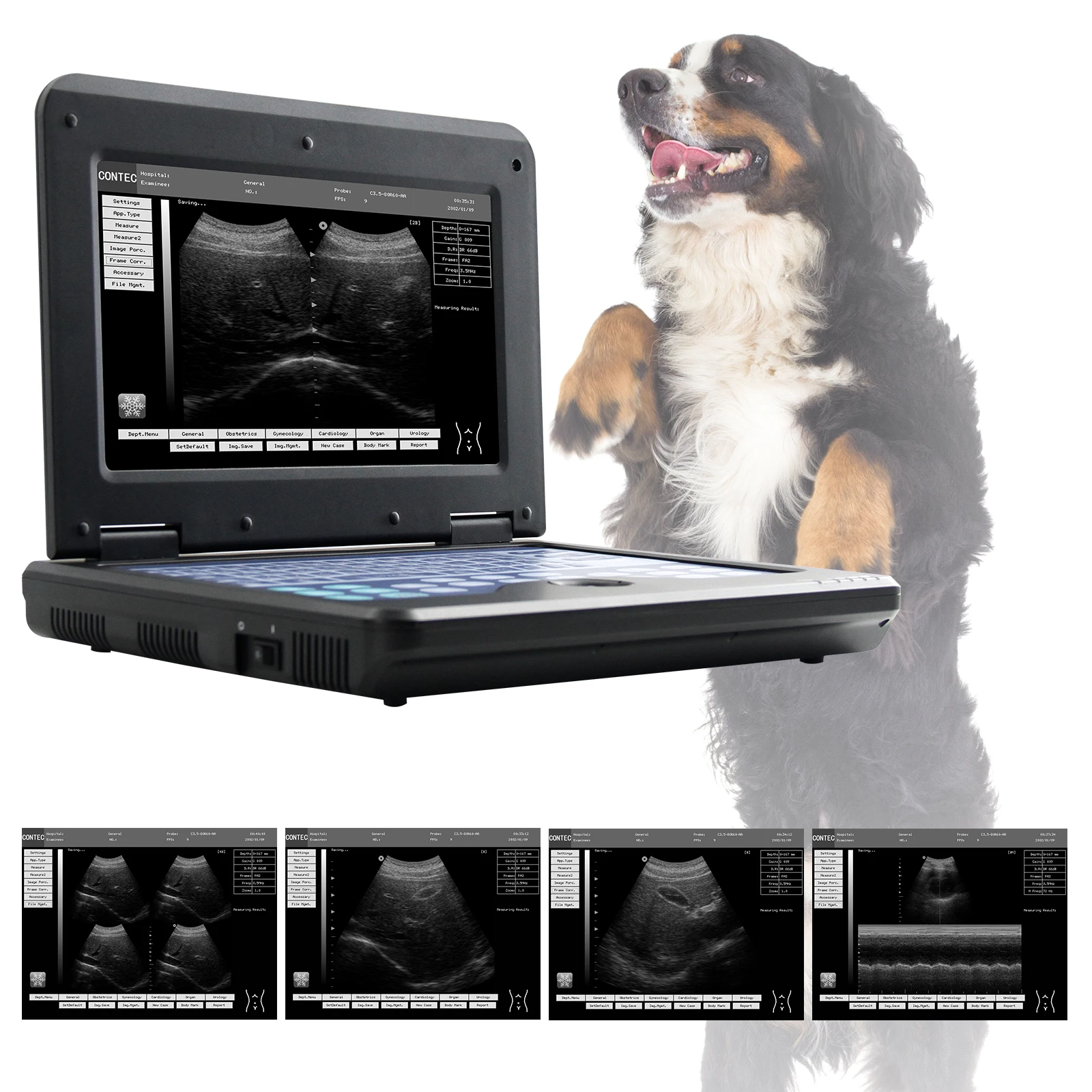 CONTEC CMS600P2 ultrasonic echographe portable ecografo ultrasound vet ultrasound machine