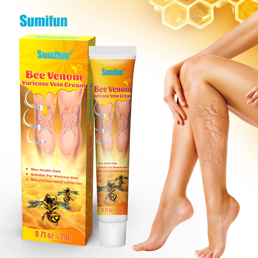 Wholesale Effective Varicocele Ointment Original Vasculitis Varicose Vein Cream for Leg