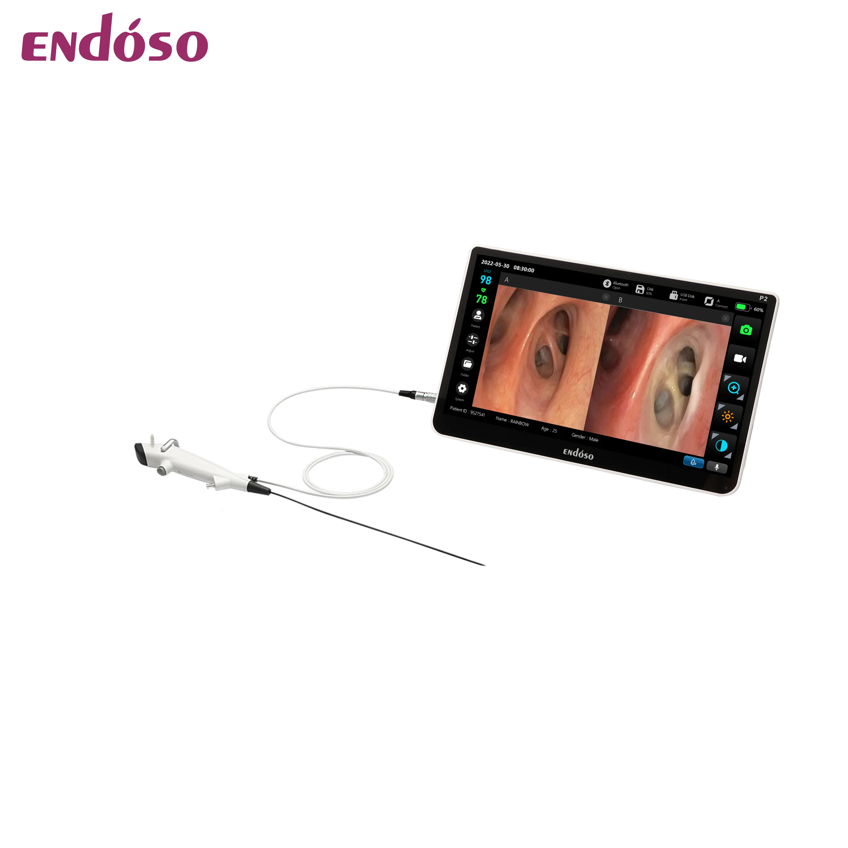 Supplier Hot Selling HD Endoscope Camera Digital Cystoscope USB Port Disposable Flexible Cystoscope with CE