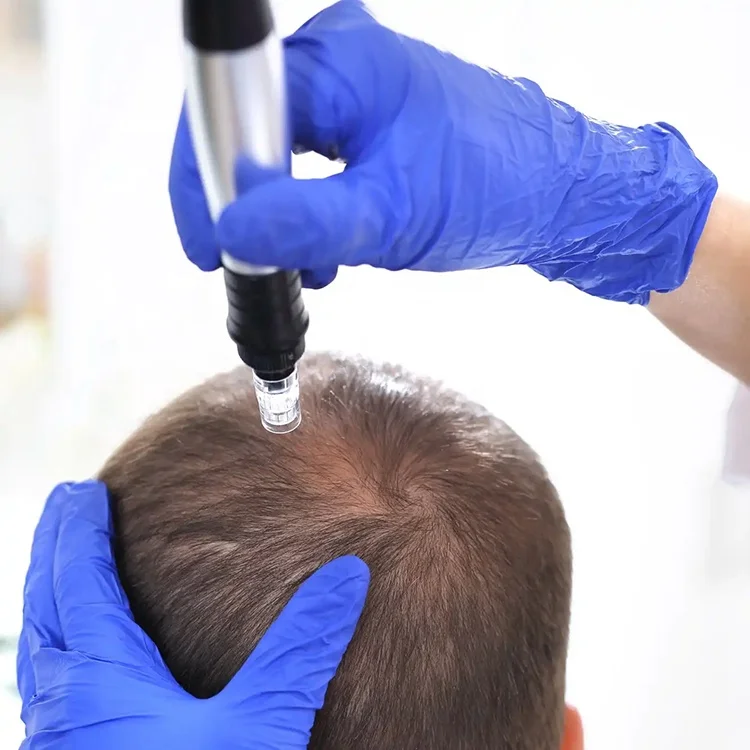 Hot selling Activate hair follicles Meso microneedle into the hair growth horn freeze-dried powder keratin essence kit