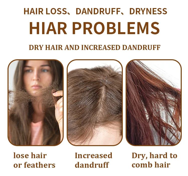 Anti-Loss Ginger Essence Oil for Hair Care Scalp Moisturizer with Smoothing and Nourishing Features