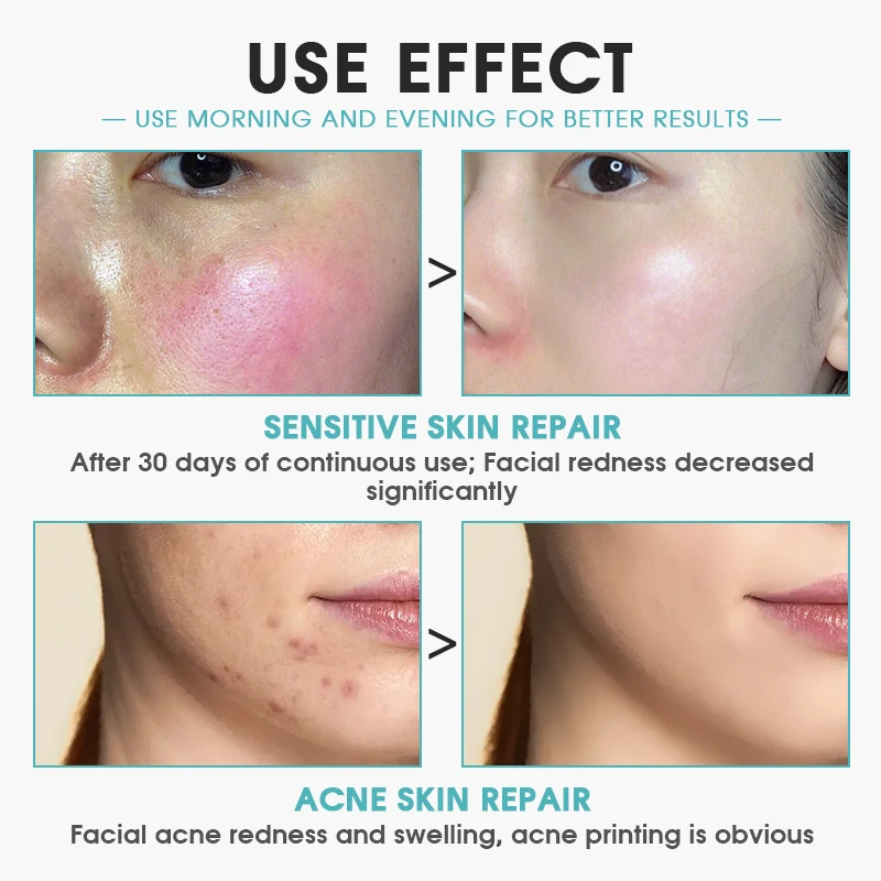 Face-Serum-Capsules Paraben-free Anti-aging & Moisturizing and Oligopeptide & Collagen Peptide Repair Freeze-dried Powder