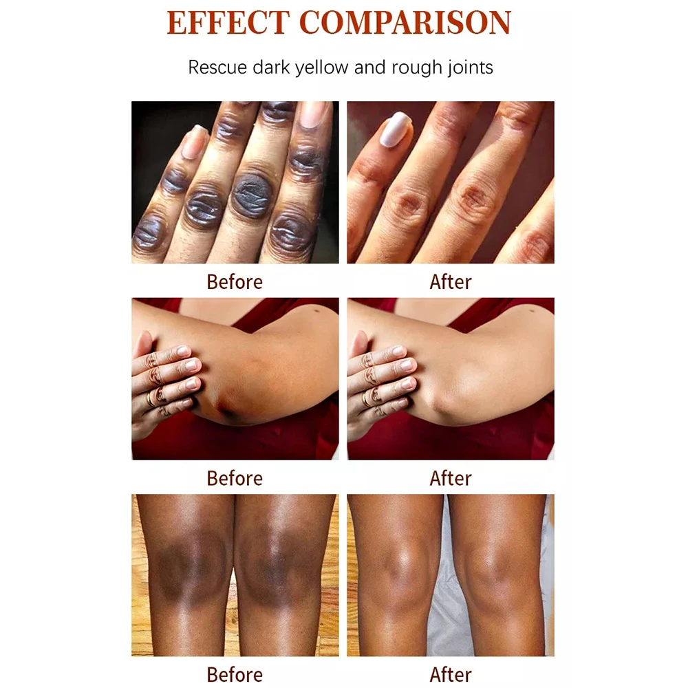 Korean Natural Vegan Neck Facial Vitamin C Acne Pimples Dark Spot Strong Remover Cream