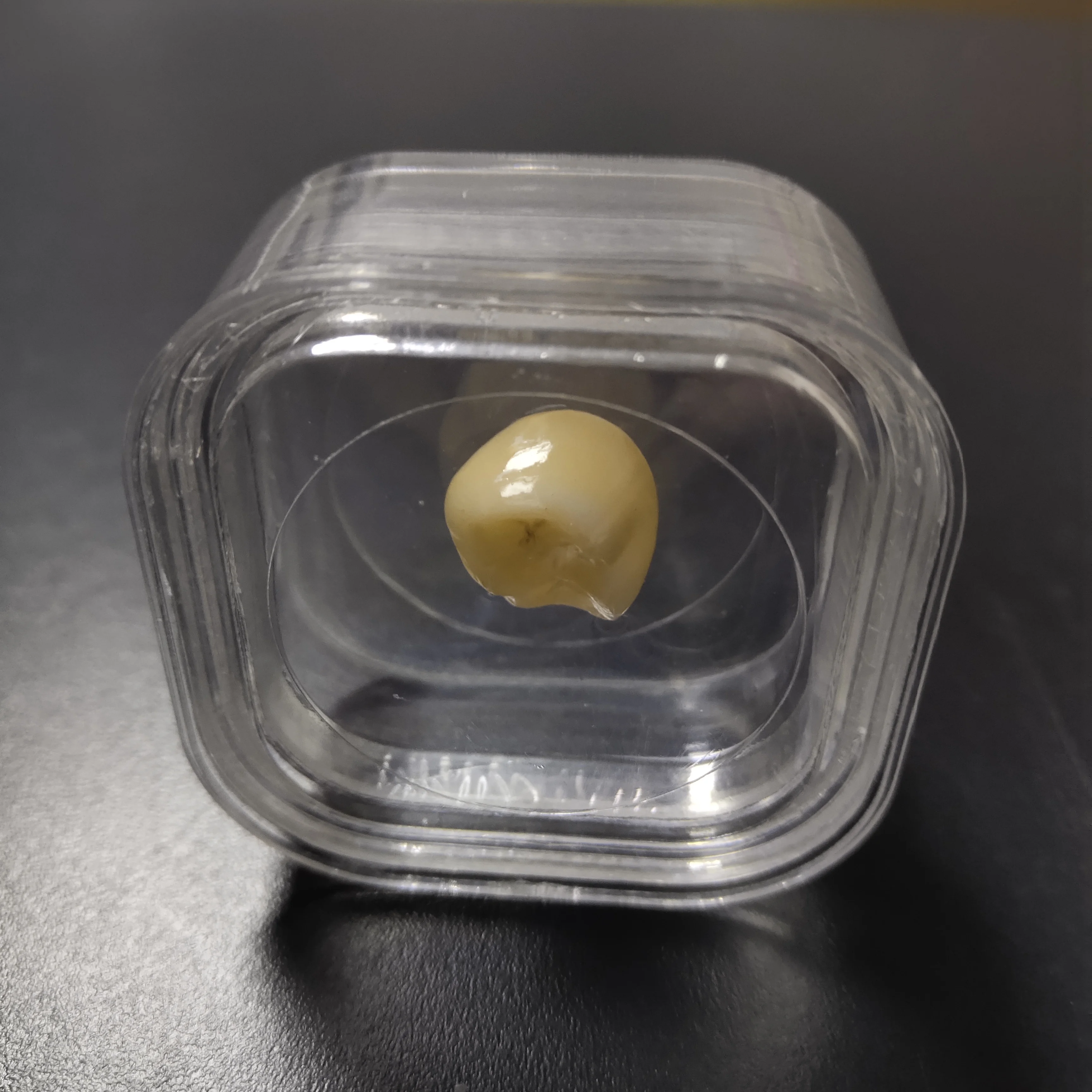 Wholesale Plastic Transparent Teeth Orthodontic Retainer Denture Storage Box - 1.5 inch