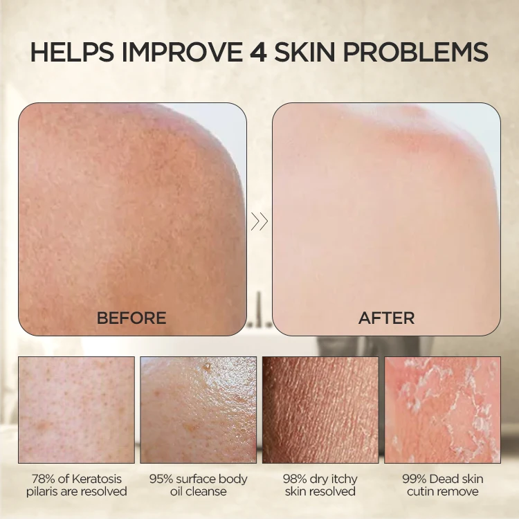 100% Viscose Deep Cleaning Skin Moroccan Kessa Exfoliating Mitts Body Scrub Glove For Home And Hotel Use