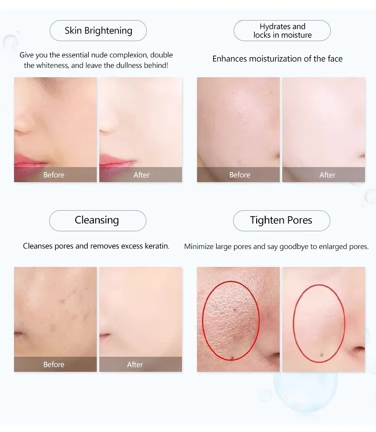 Non-Invasive Mesotherapy Cryo Lipolysis Cryo Machine Have Cool And Hot Therapy Contracts Capillaries Hot Electroporation