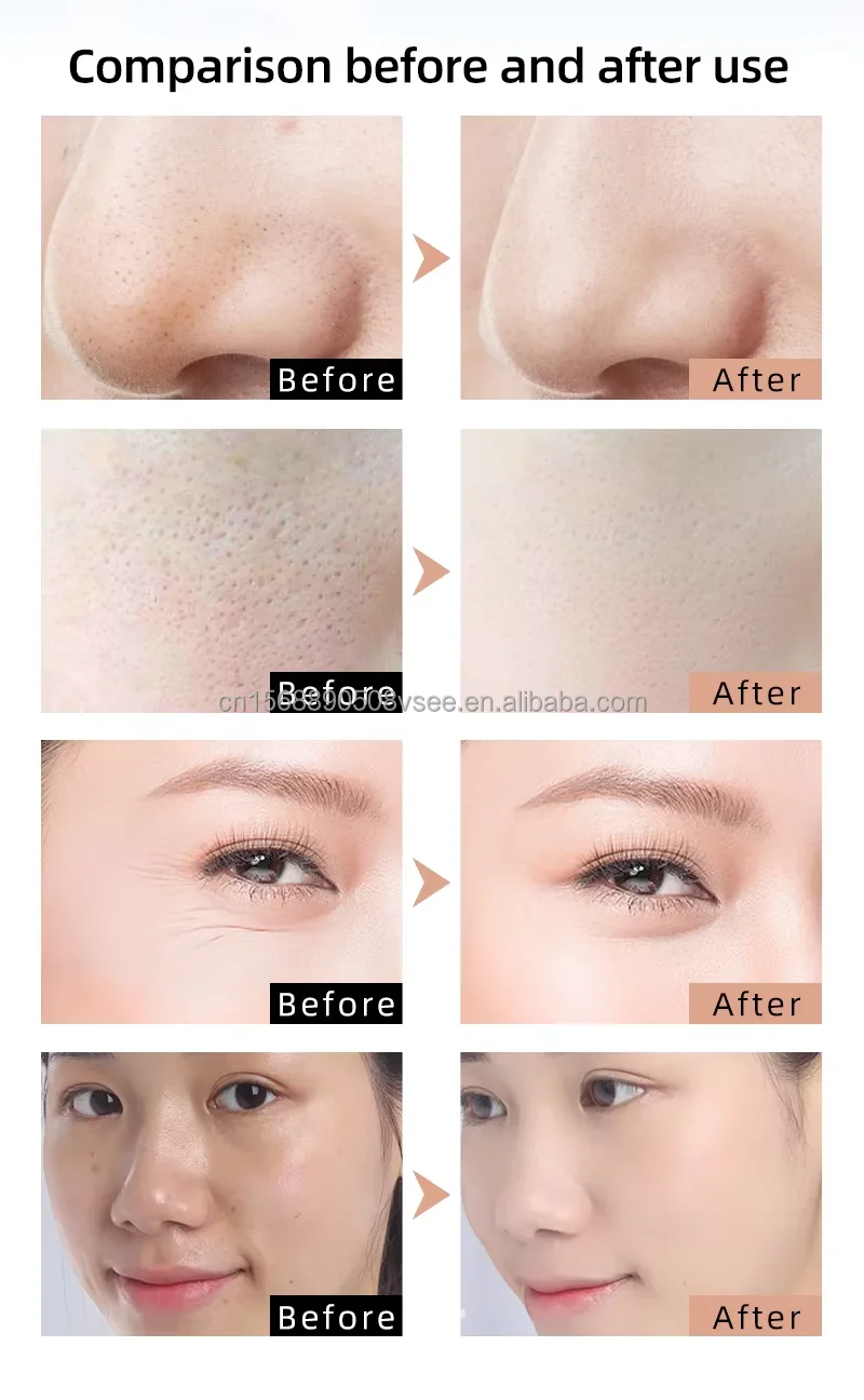 2024 New Trending LED Blue Light Facial Mask 415/605/630/850 Nm 7 Colors Silicone Gel Red Light Therapy Infrared LED Face Mask