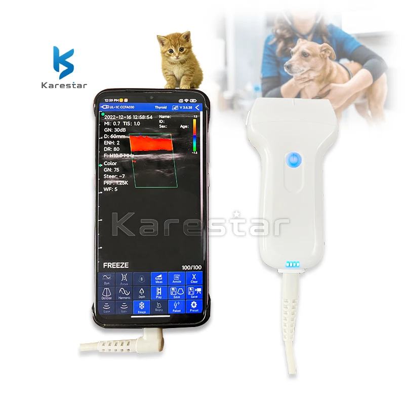 Handheld medical wifi wireless ultrasound probe scanner machine portable animals use wireless probe