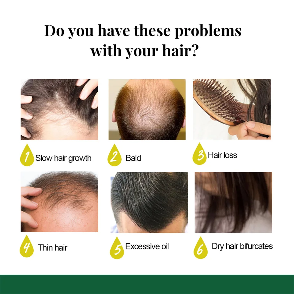 Ginger Germinal Oil (4).jpg