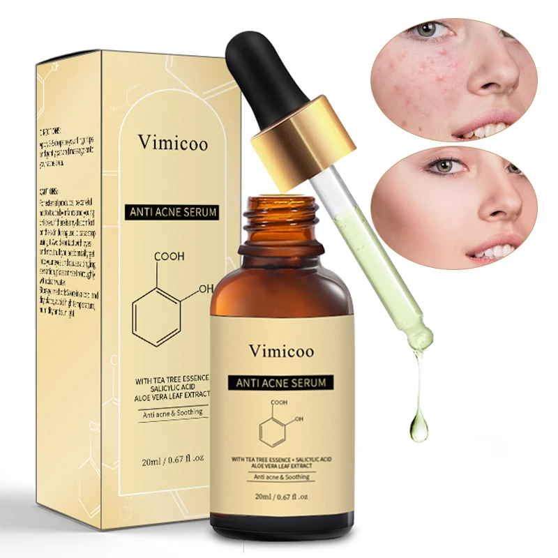 Wholesale Organic Vegan Herbal Salicylic Acid Anti Acne Removal Tea Tree Face Serum For Acne Treatment