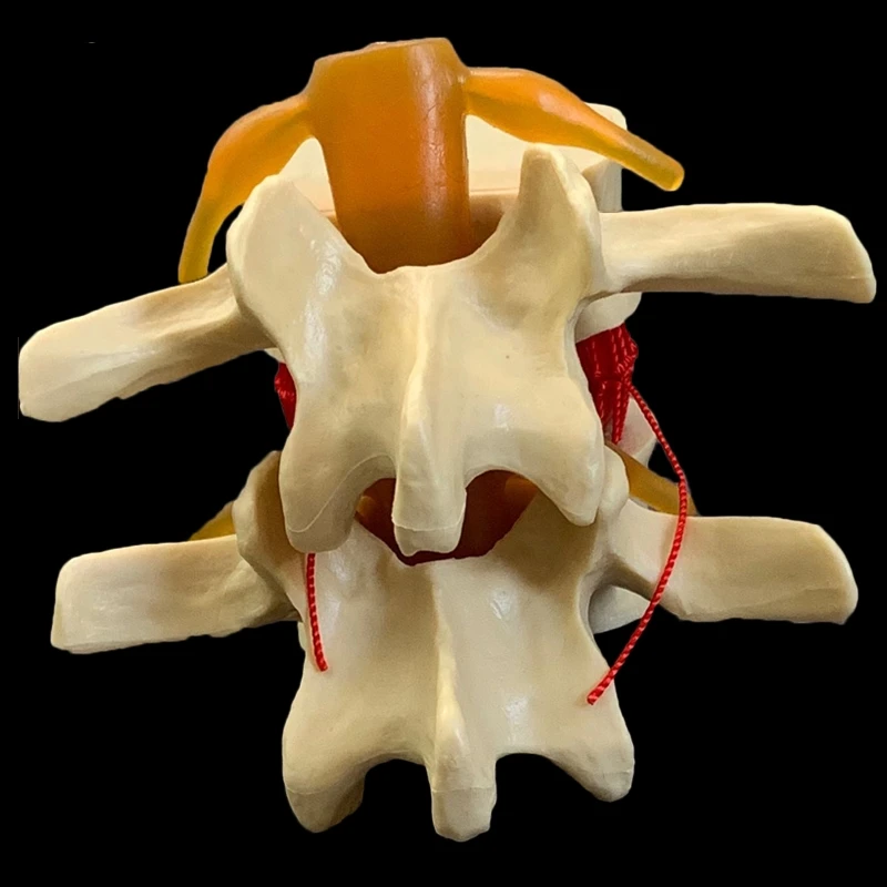 Spine Model Human spine model full size demonstration model of human lumbar intervertebral disc compression for medical teaching