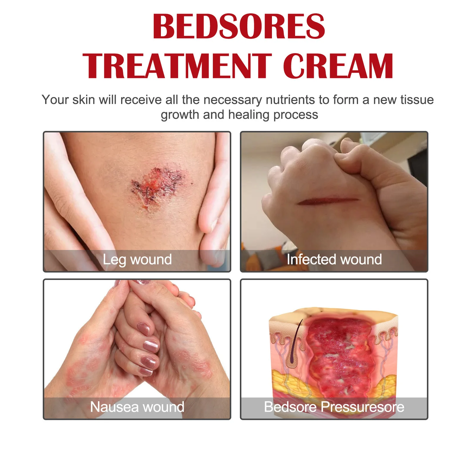 Private Label Fast Healing Bedsores Treatment Ointment Wound care Ointment Bedsores Cream Body Care Cream 20g