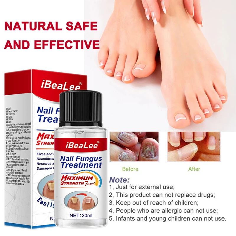 iBeaLee Nail Fungus Treatment 7DAYS Repair Essence Serum Hand Care Nails Foot Fungal Removal Cream Anti-infective Onychomycosis
