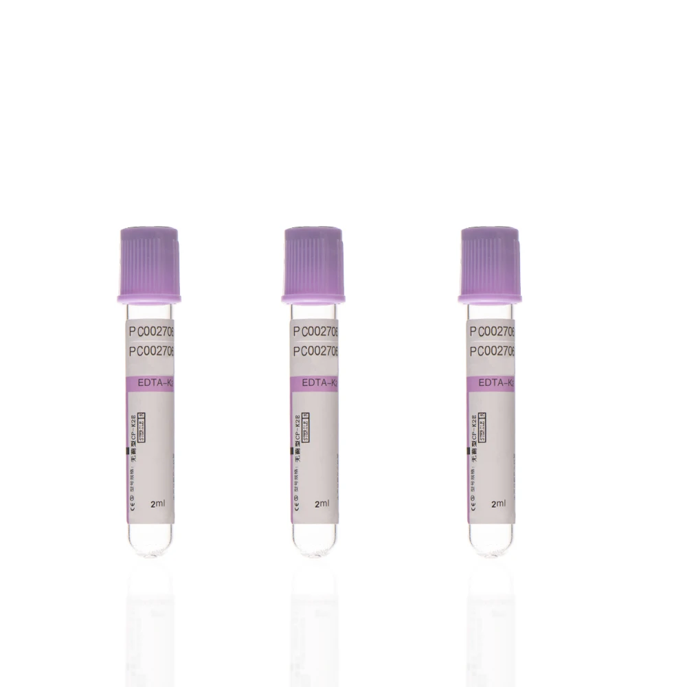 Factory Direct Sales Of High Quality Disposable Vacuum Blood Sample Collection Tubes