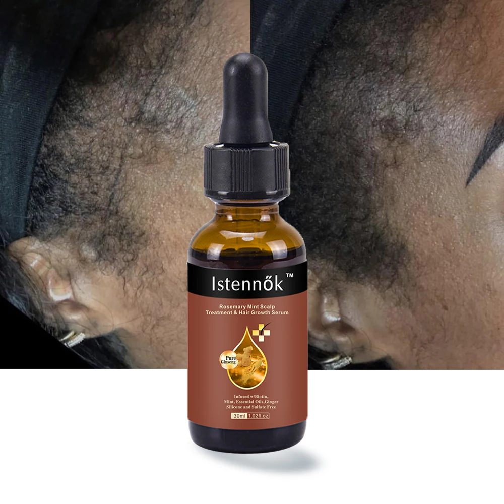 Natural Hair growth oil Effect Formula Men Women Rosemary Castor Oil Scalp Elixirs Hair Serum Loss Treatment Hair Growth Oil
