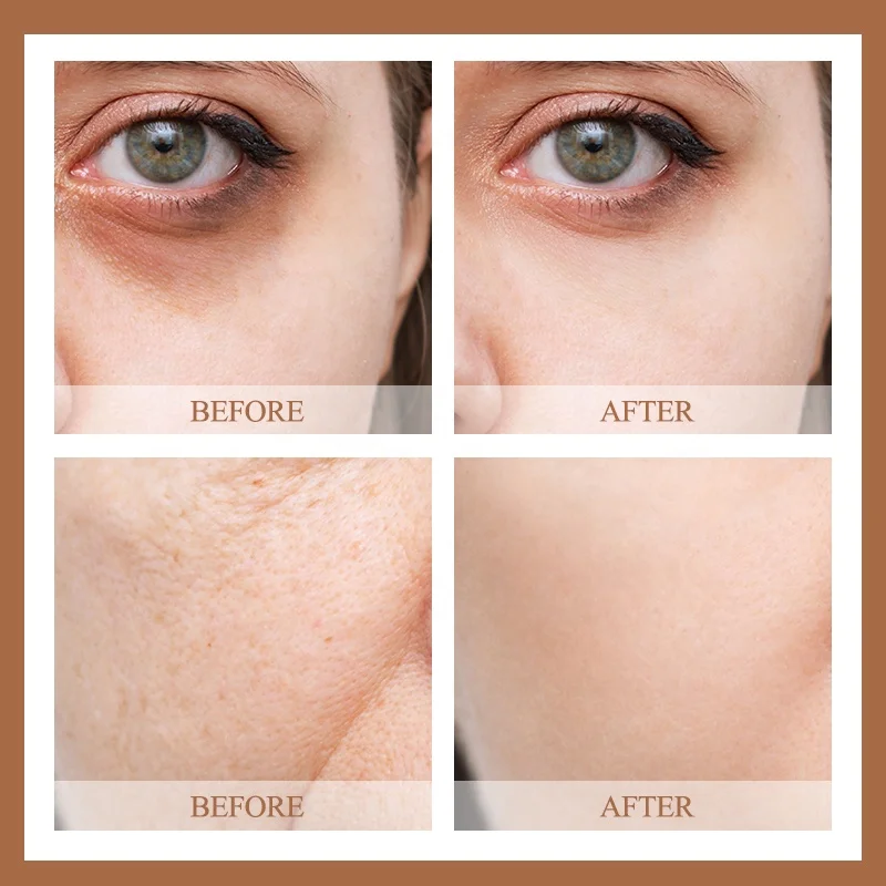 New Arrival Face AHA  BHA Peeling Solution Niacinamide Hyaluronic Acid Arbutin Buffet Lactic Acid Caffeine Skin Care Serum OEM