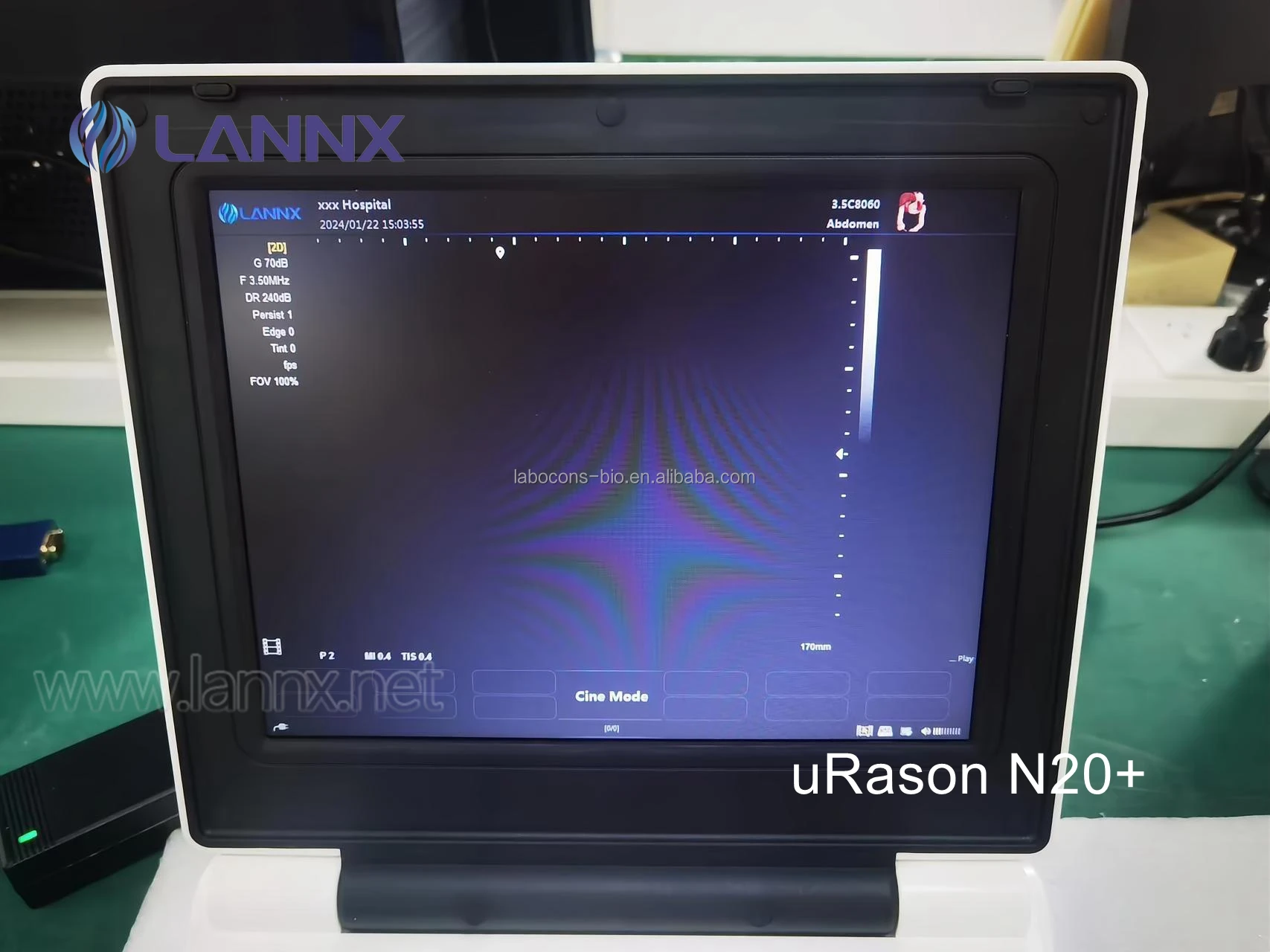 LANNX uRason N20+ Cheap price 12.1-inch Portable B/W Ultrasound Machine System laptop 2D OB GYN P/W ultrasound echographe