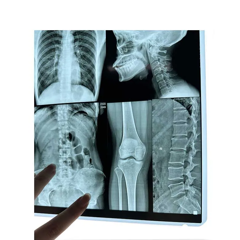 Medical X-ray dry film and dry imager replacement of AGFA Drystar 5302 and FUJI drypix 3500/2000