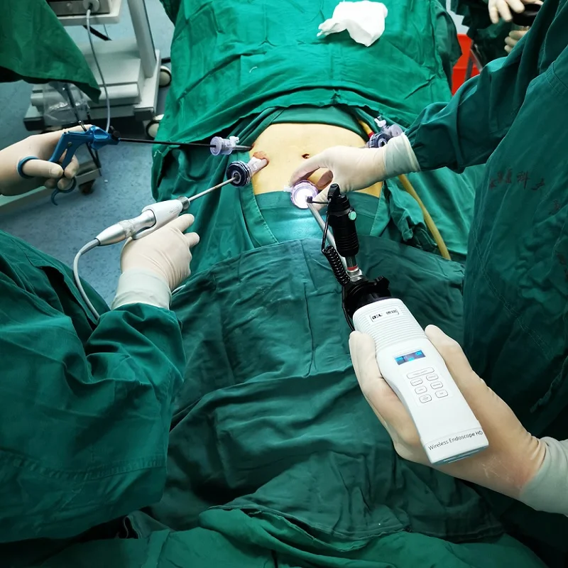 New Endoscopy Defogger system with battery Surgical instrument Endoscope anti fog device minimally invasive operation clean aids