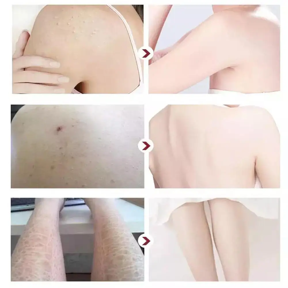 Private Label Organic korean Fruit scrub body Exfoliating Smooth Skin care Fruit whitening face and body scrubs jars