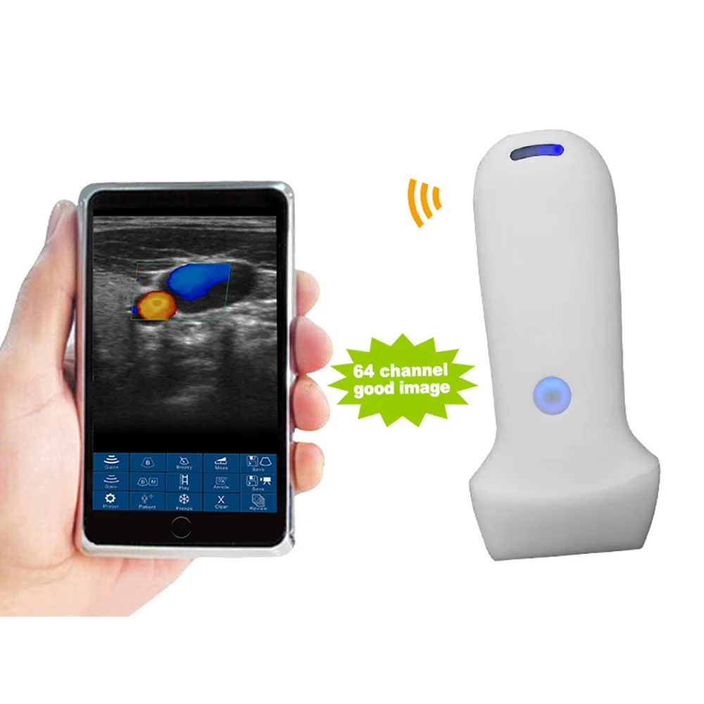 Suresult Focused Ultrasound Transducer for IPhone Hand-Held Sonography