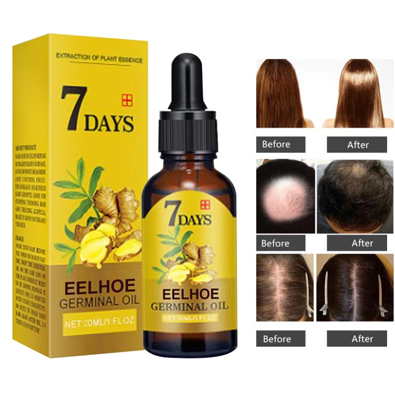 Hot sale 7 days rapid hair growth essence oil hair loss treatment growth hair care essential oil Both men and women