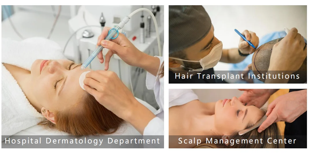 Professional Scalp Management Machine Hair And Scalp Analysis Machine Ai Scalp Analyzer