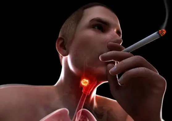 
2021 hot sell Chinese medicine for relieving sore throat Yanyan Tablets 