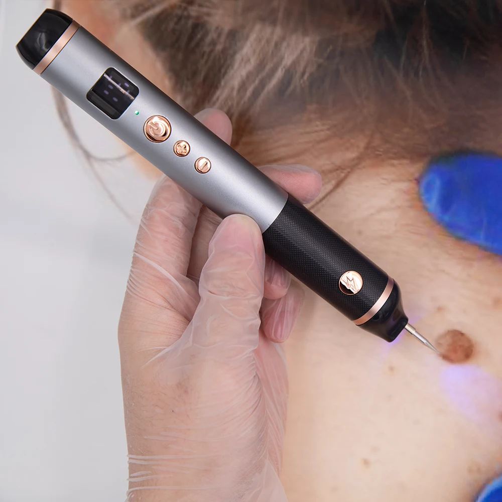 Trends Plasma pen Facial Tag Removal painless Plasma Pen Cauterizer Removing Electrocautery Wart Papilloma Skin Eraser Mole Pen