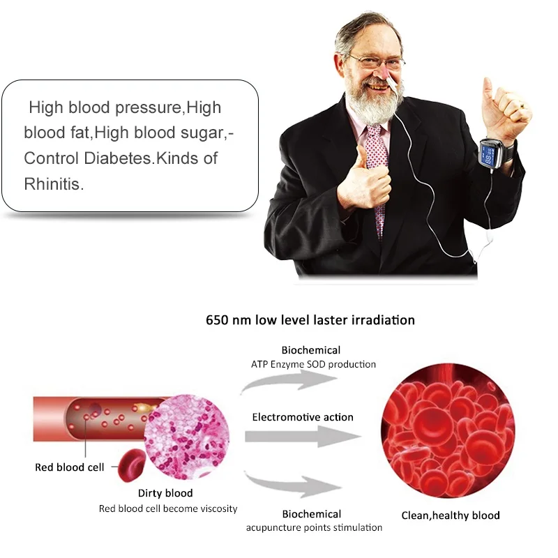 Медицинское оборудование холодный лазер часы терапия артериального давления наручные диабет 650 нм полупроводниковый lllt терапевтический