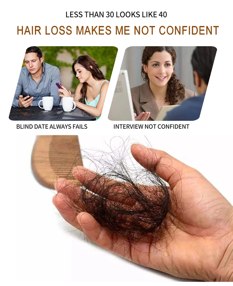 SEVICH ginger anti hair loss regrowth hair treatment shampoo