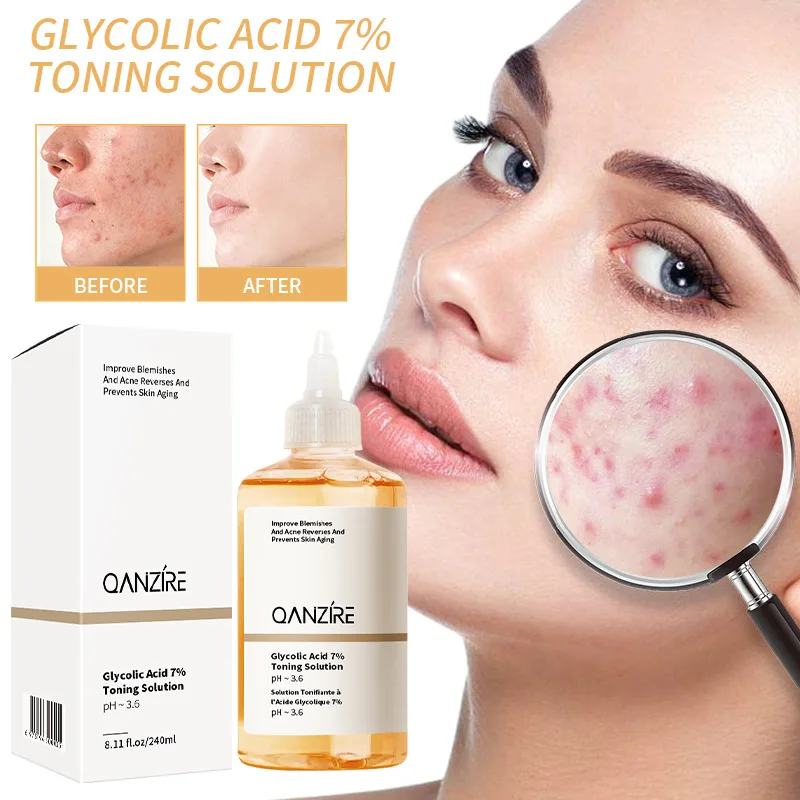 Private Label Glycolic Acid 7% Toning Solution Hyaluronic Acid Anti-Acne Moisturizing Acid Toner