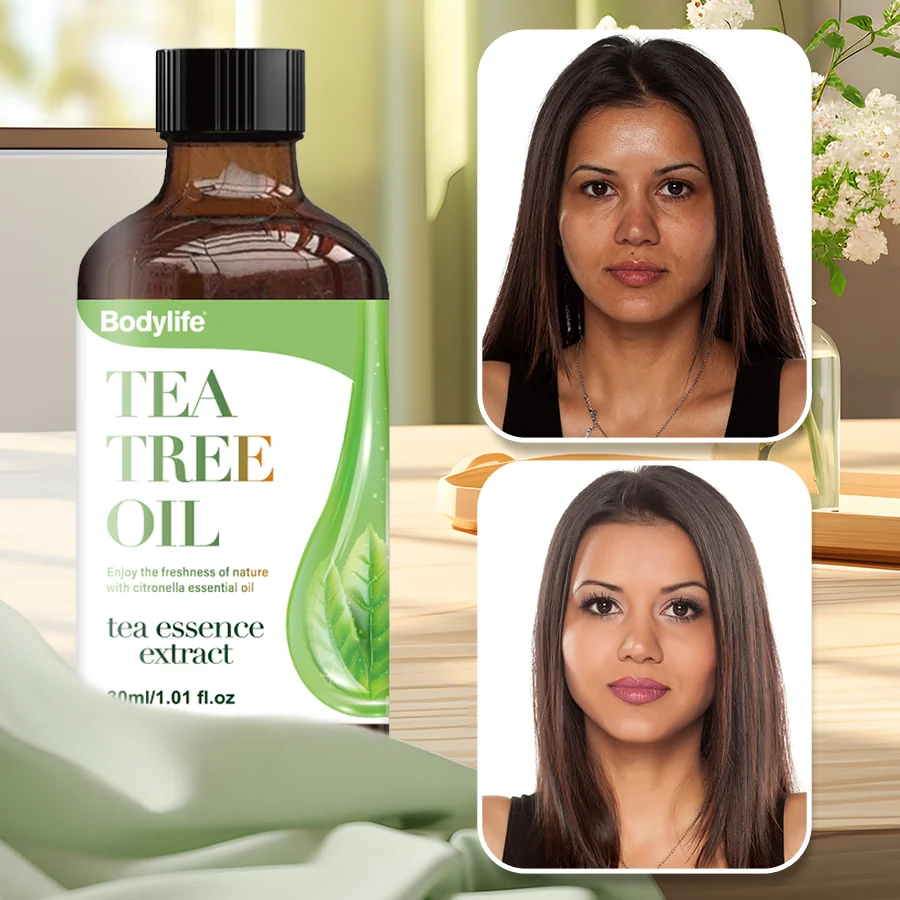 120ml Tea Tree Essential Oil Pure And Natural Organic Tea Tree Oil for Skin Hair Care