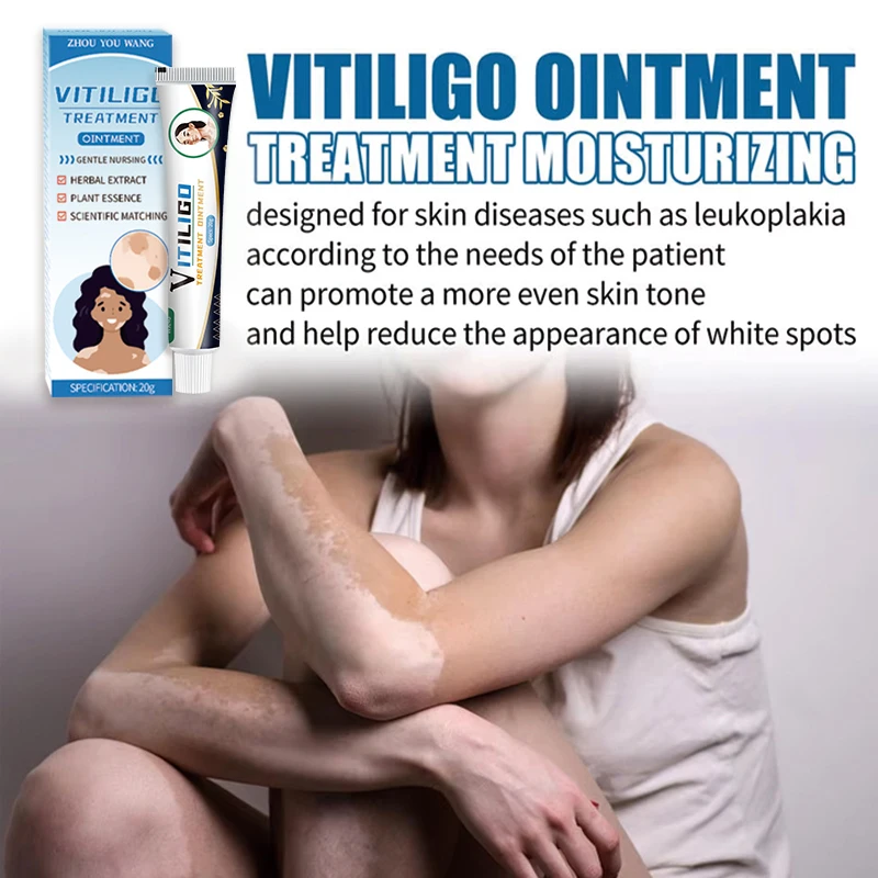 20g vitiligo ointment Body white spots pigmentation skin itchy scars vitiligo