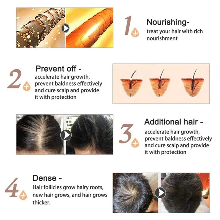 Средство для лечения волос Alopecia спрей здорового роста сыворотка ежедневного использования семьи мужчин и