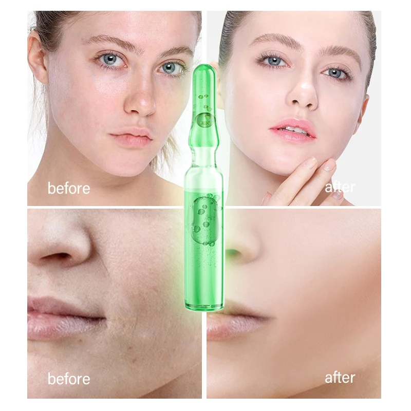 OEM Private Label Organic Vegan moisturizing acne pore improvement anti wrinkle aging acne whitening Ampoule serum of Purslane