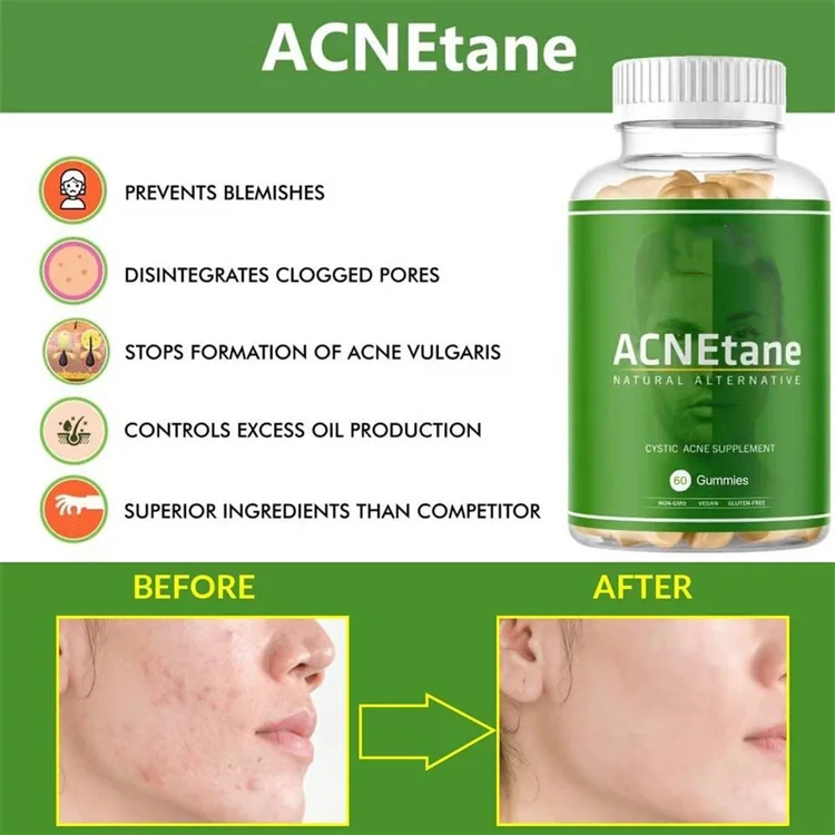 Customized Hormonal Skin Acne Vitamins and Supplements skin care gummies