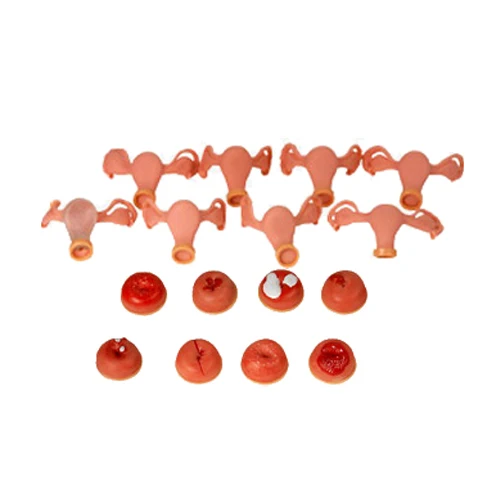 Uterus Simulator and Cervical Lesion Gynecological Anatomy Model