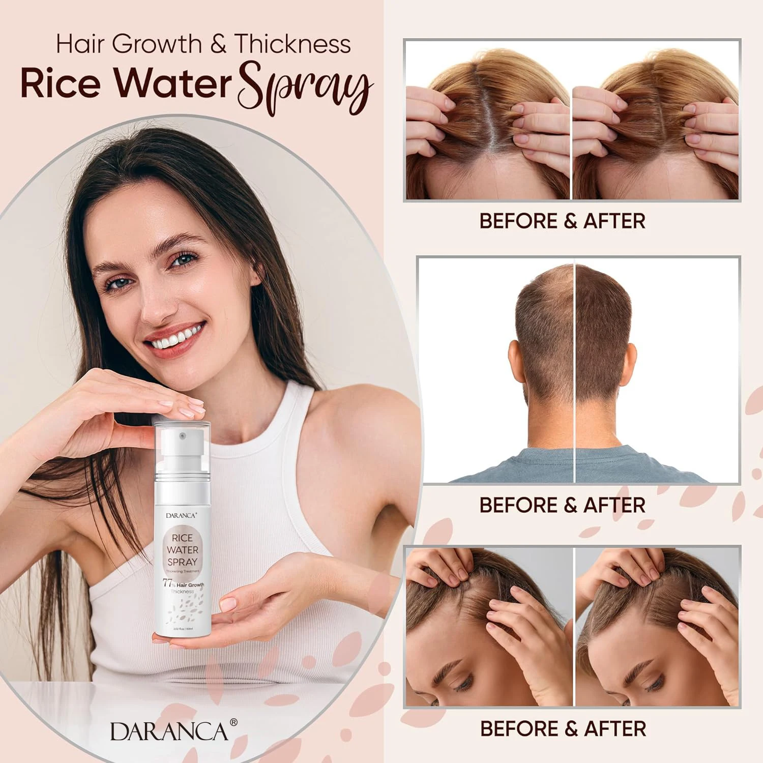 Hotselling OEM ODM Rice Water Hair Growth Spray Custom Organic Anti-Hair Loss Treatment Regrowth Spray