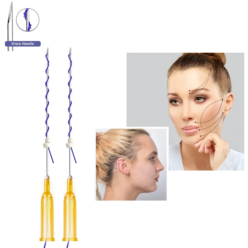 Korea quality skin face lifting barbed small 25G 60mm screw cog mini hilos pdo thread for eye brown lifting