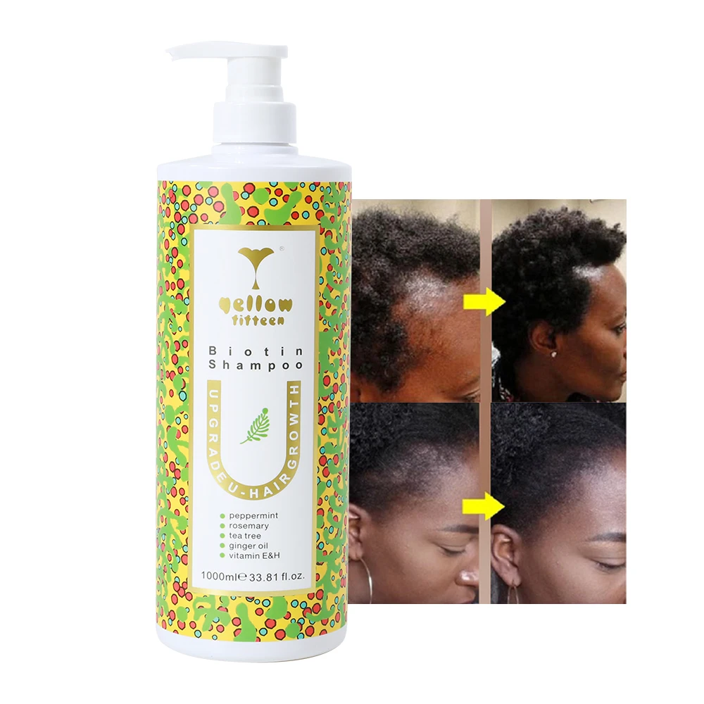 Система против выпадения волос с логотипом на заказ силиконовый бессульфатный шампунь для роста