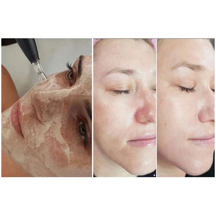 Make up foundation BB Cream Treatment Glow Anti Aging Serum Meso Whitening Brightening Serum