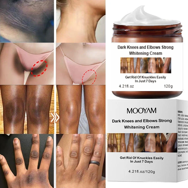 wholesale niacinamide dark knees knuckles elbows armpit whitening cream,woman private parts snow bleaching cream for dark skin